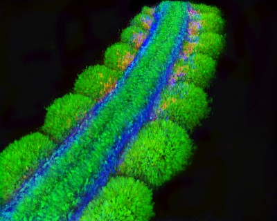 Professor Christophe Marcelle and his team have deciphered how signals from neural crest cells (pictured in blue) regulate the development of the first muscle cells.
