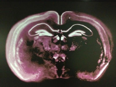 Severe trauma is the leading cause of death worldwide in years under 45